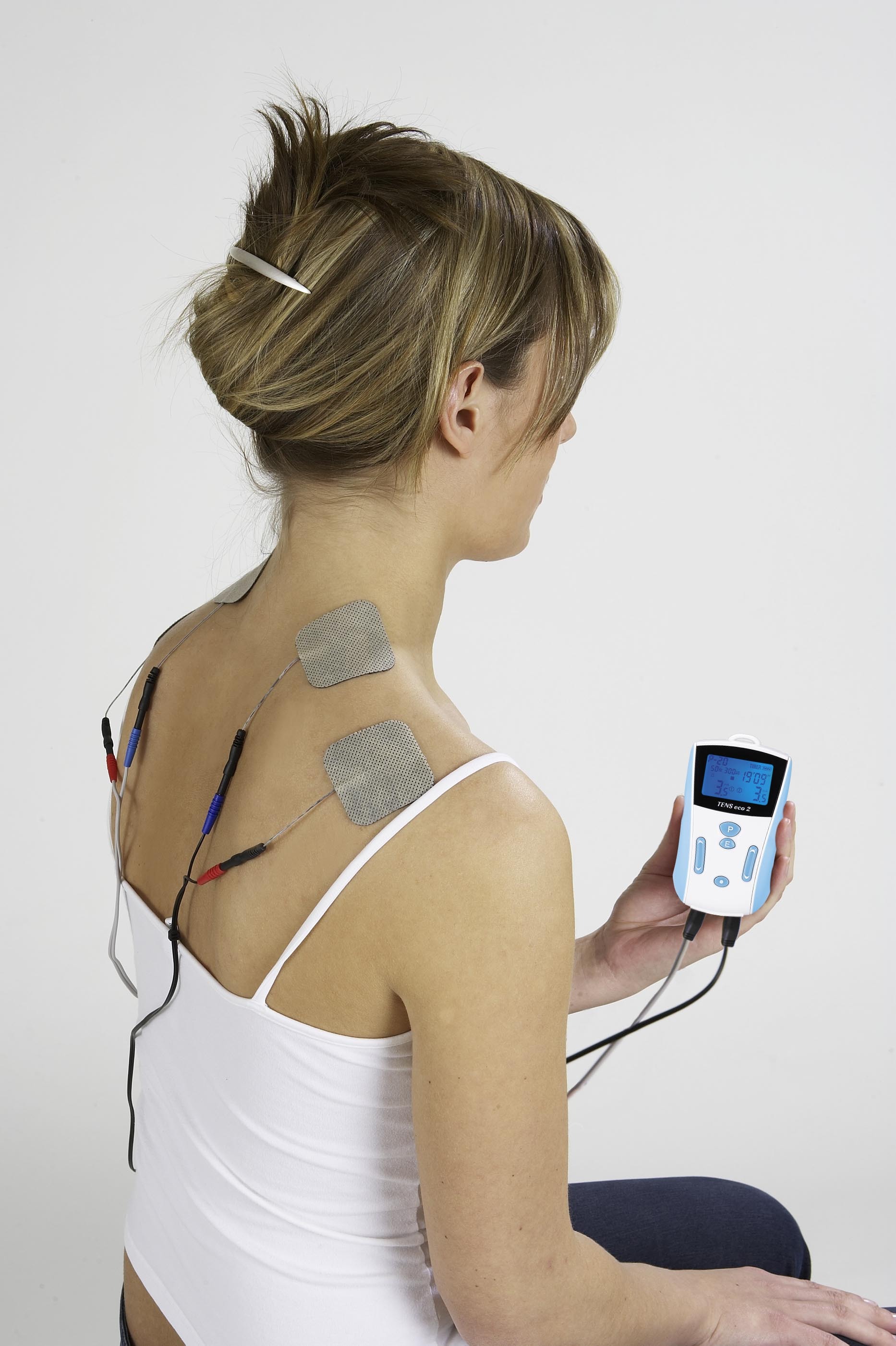 A picture showing a neurostimulator with electrodes